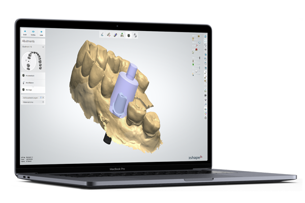 Digitales Rendering eines Gebiss mit Abutment